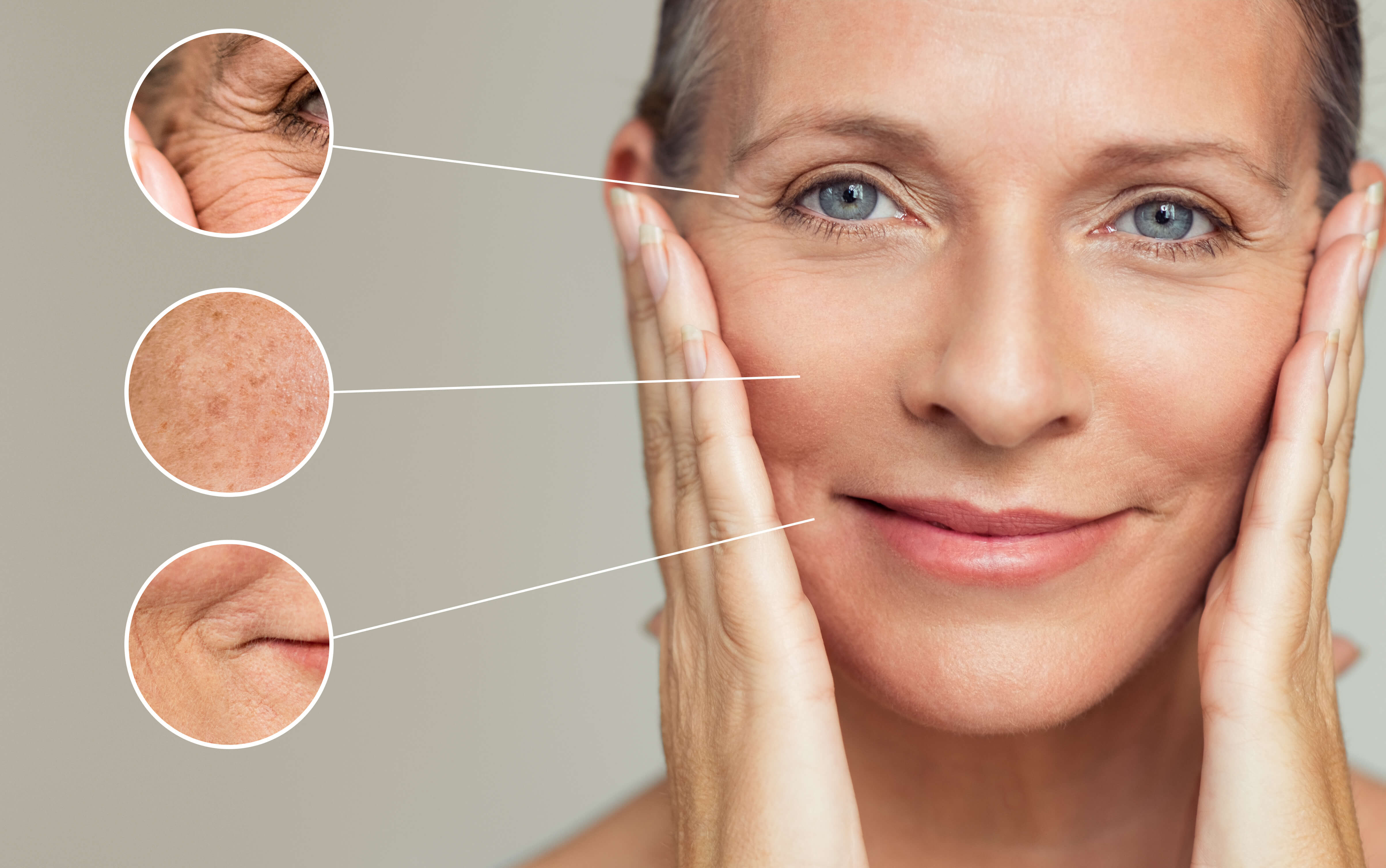 Woman showing signs of aging with close-up highlights of wrinkles, pigmentation, and skin texture — ideal candidate for HALO® laser skin resurfacing