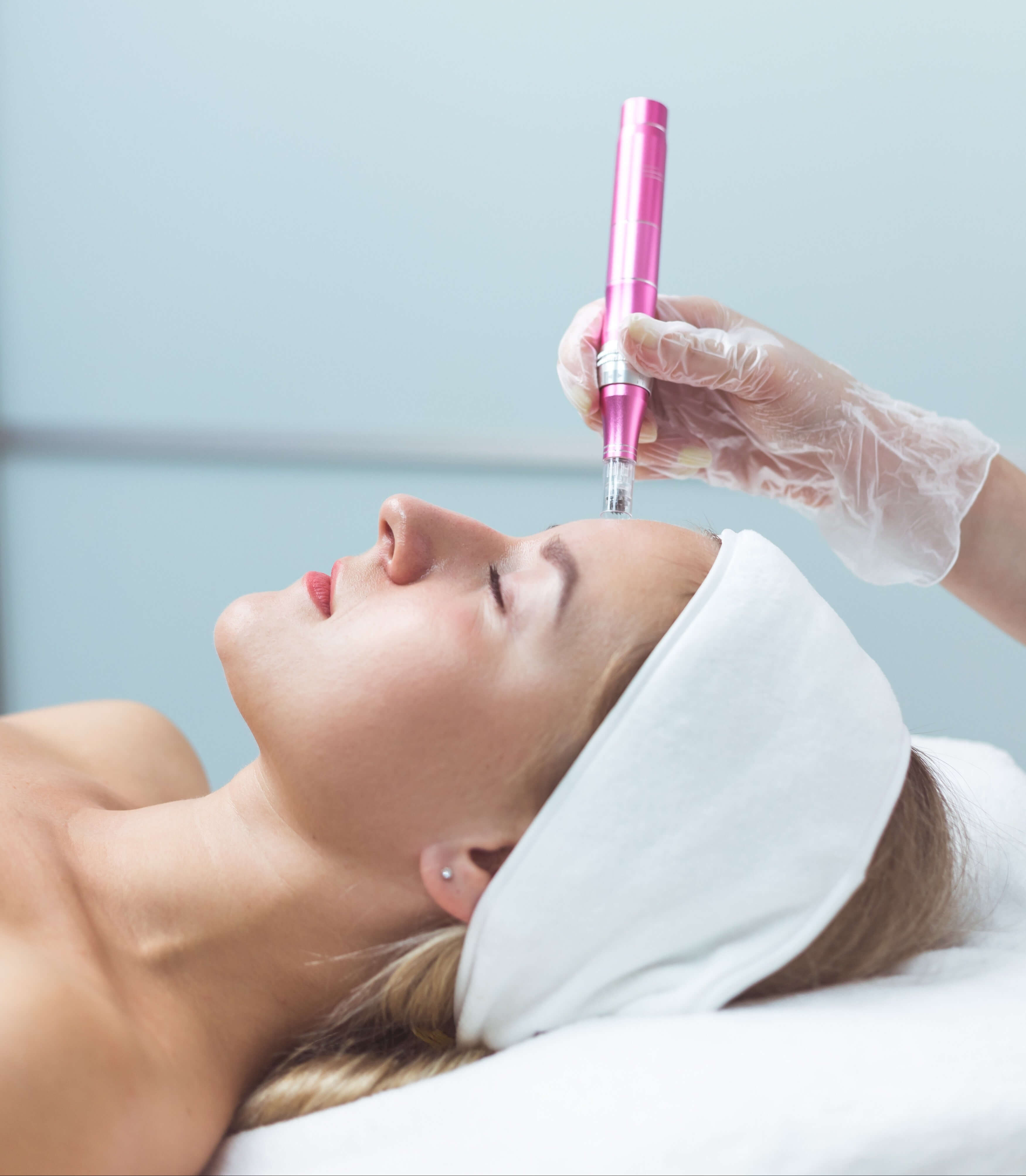 Woman receiving microneedling treatment with a pink dermapen, lying relaxed with a white headband on a treatment bed