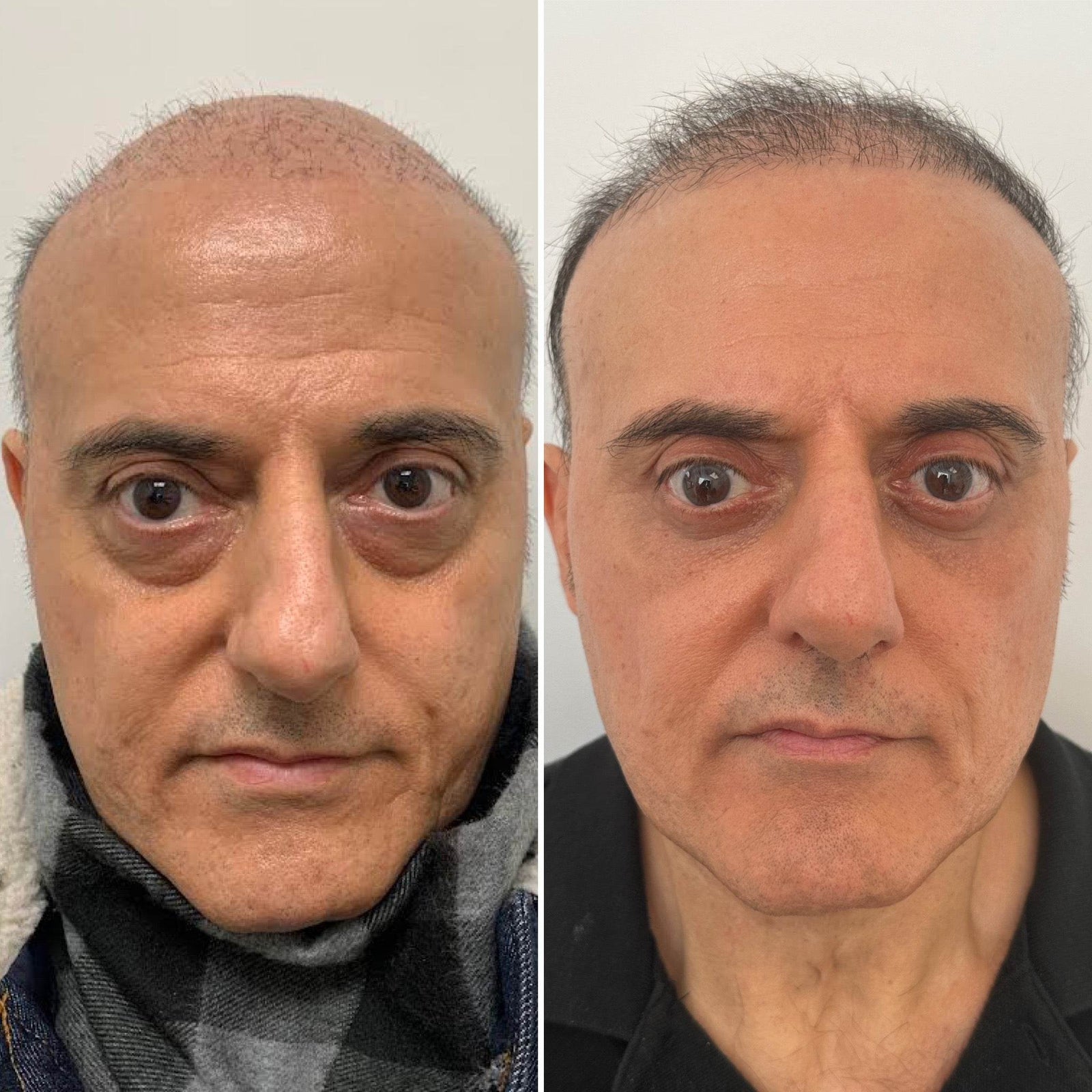 CECBEC88-5C27-44F8-8BE9-9707AAD3D3FB - Dr. Babak Maleki