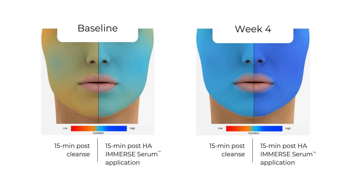 HA (Hyaluronic Acid) IMMERSE Serum - Dr. Babak Maleki