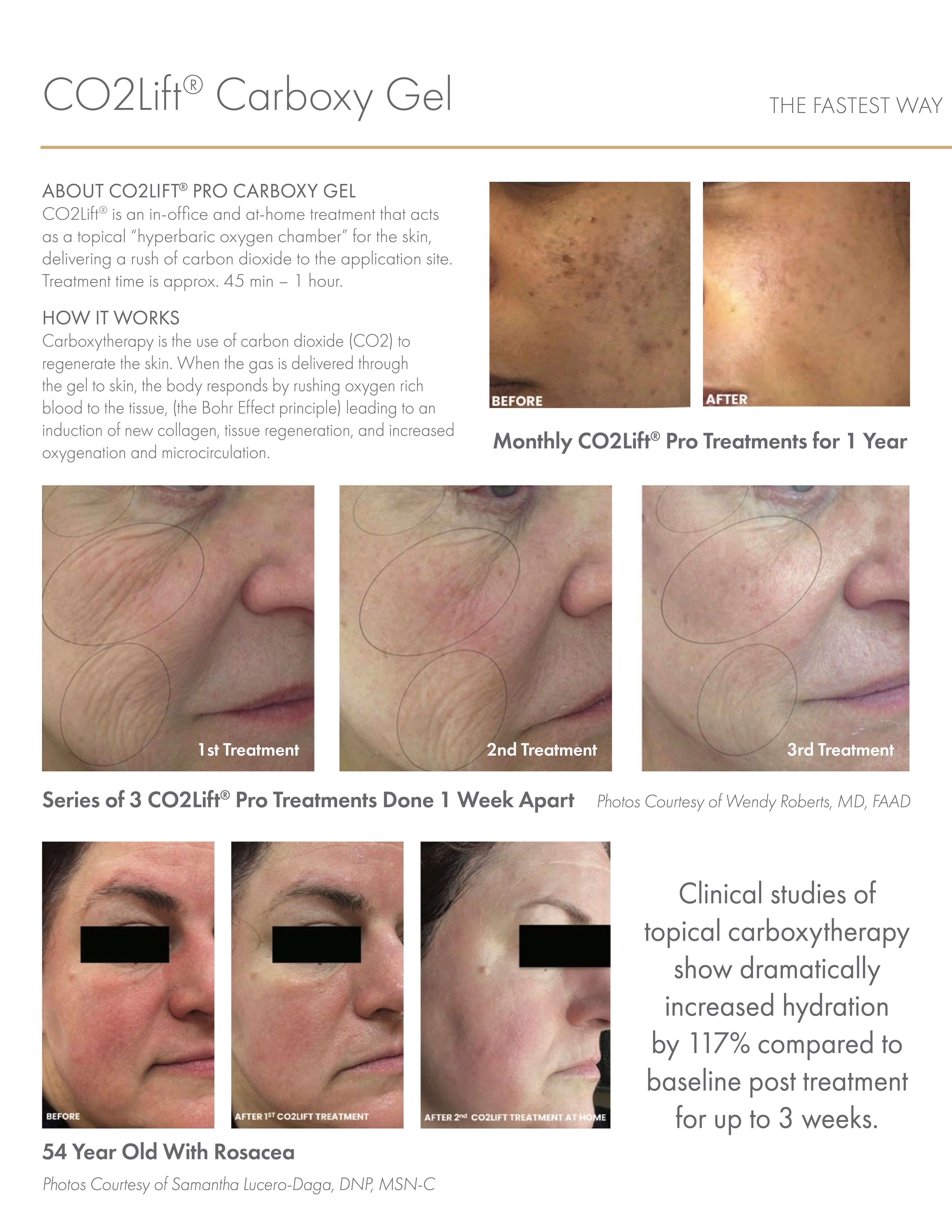 Co2 lift carboxy mask (3 Treatments pack)