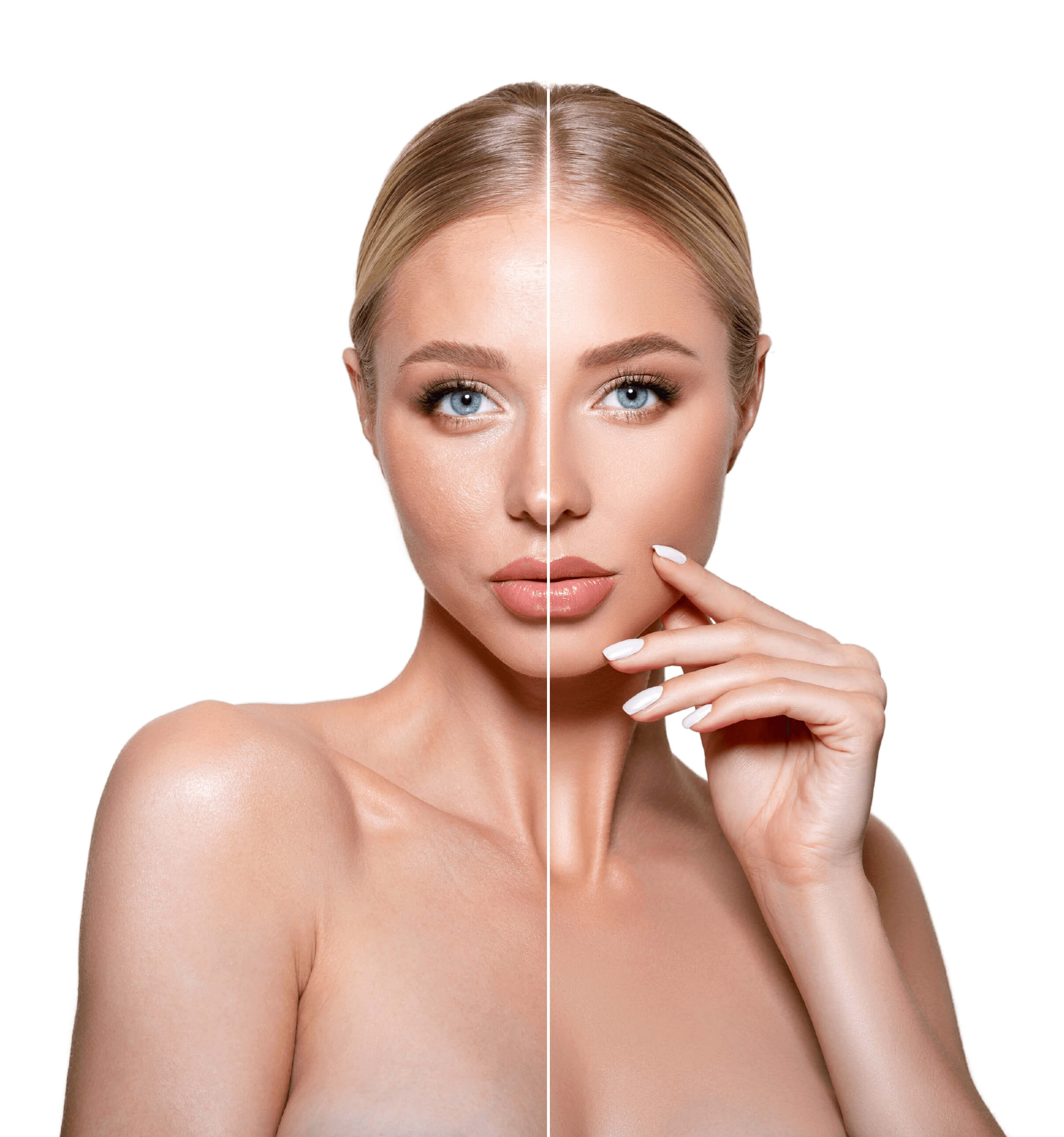 Before and after results of PRP treatment shown on a woman’s face